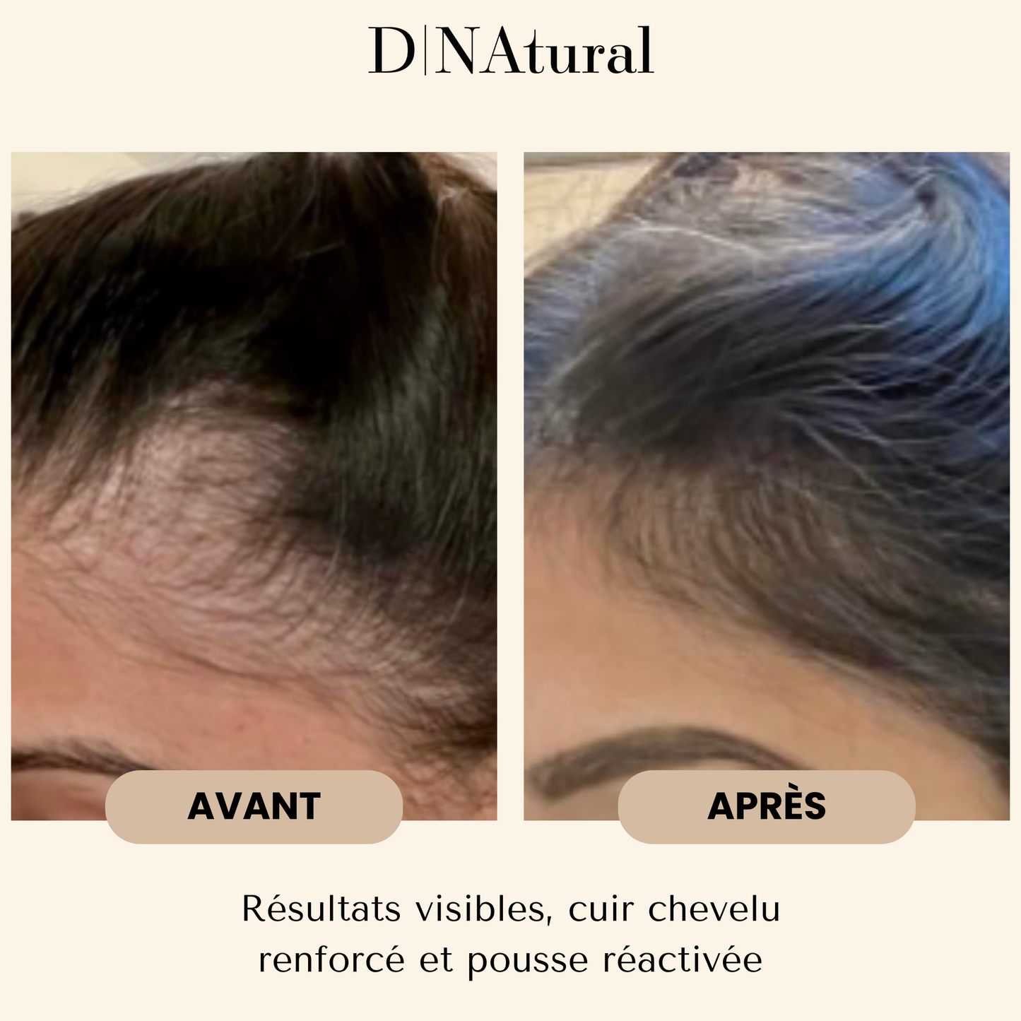 Coffret Duo Pousse