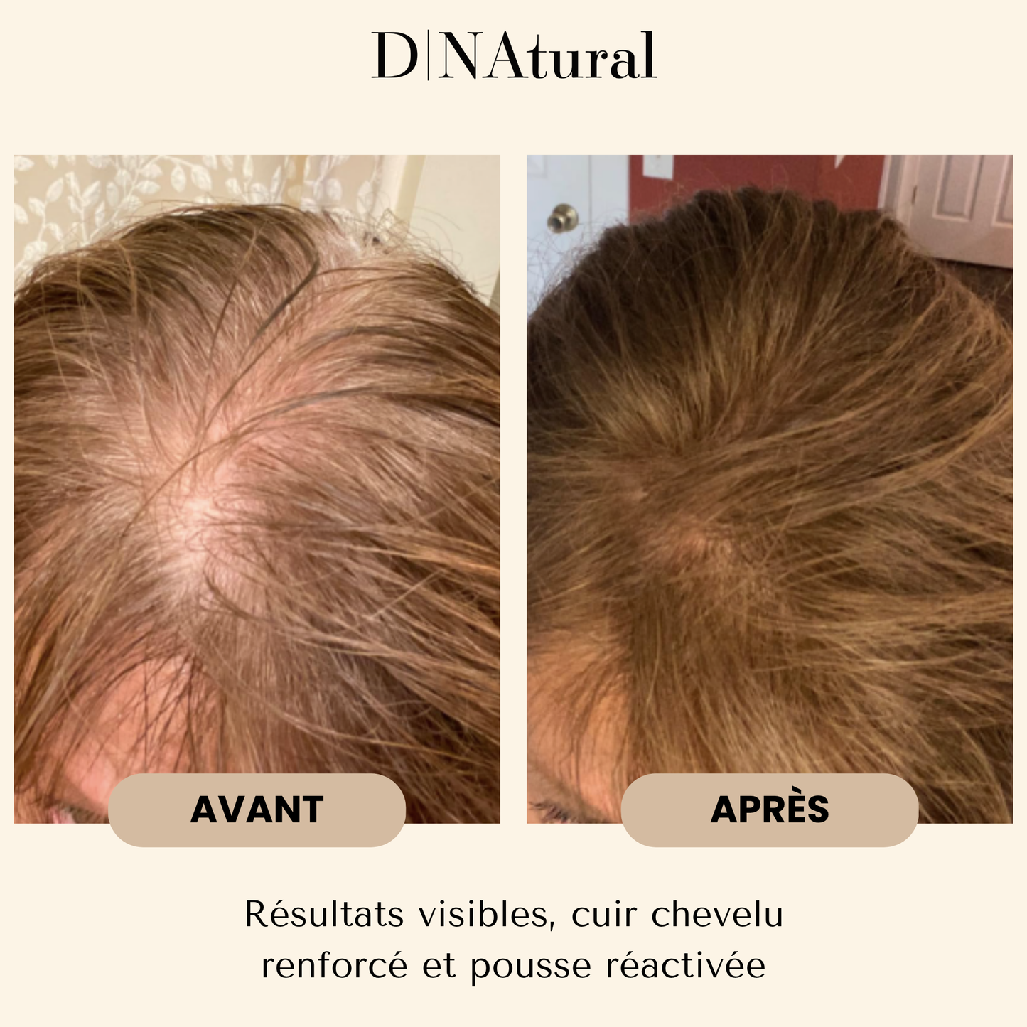 Coffret Duo Pousse